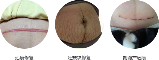 月子期修复系统